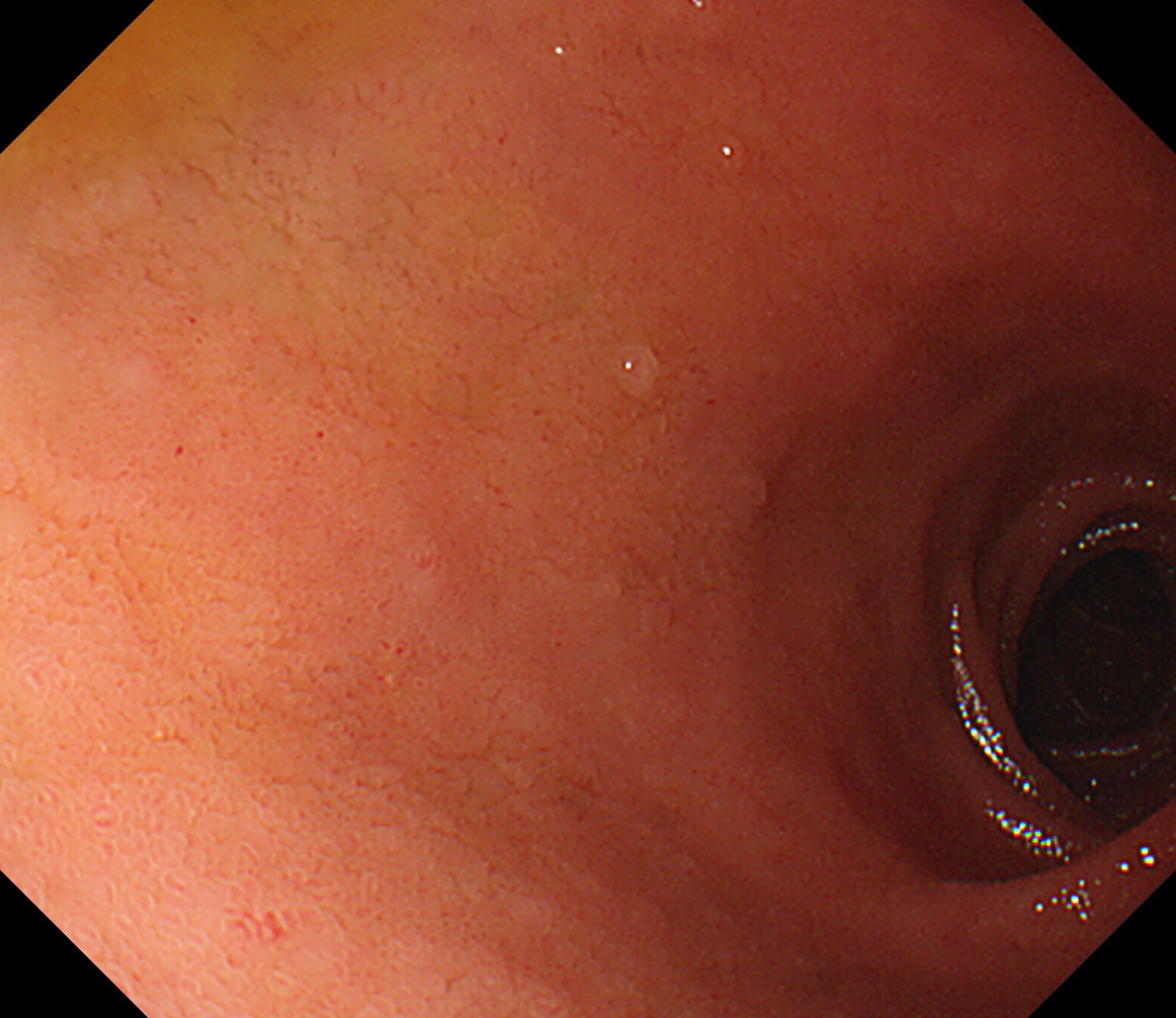 �\��w�������O��